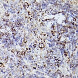 Immunohistochemistry - Anti-Thrombospondin 1 Antibody (A11512) - Antibodies.com