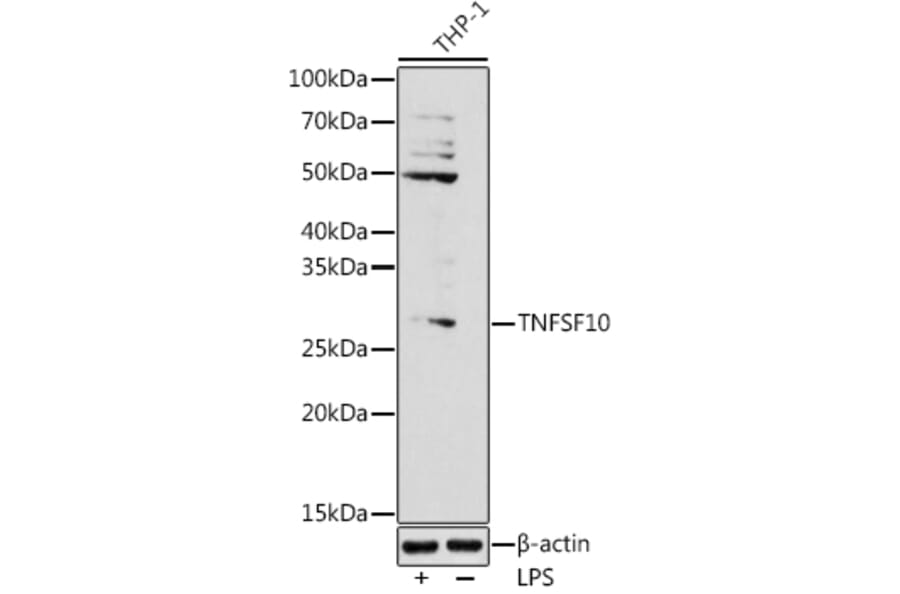 Western Blot - Anti-TRAIL Antibody (A11513) - Antibodies.com