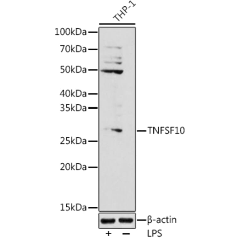 Western Blot - Anti-TRAIL Antibody (A11513) - Antibodies.com