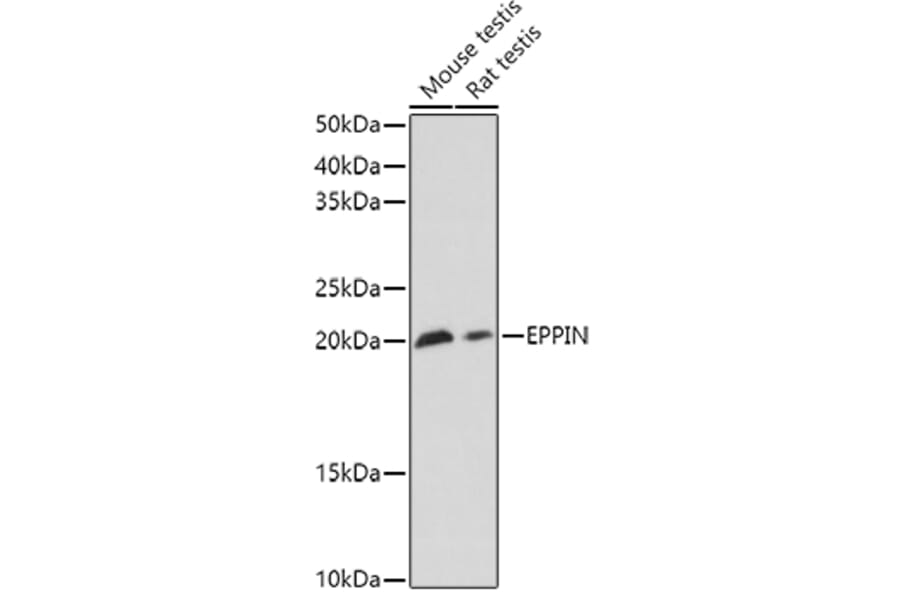 Western Blot - Anti-EPPIN Antibody (A11514) - Antibodies.com