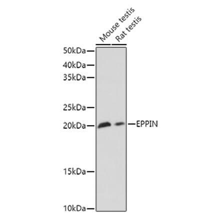Western Blot - Anti-EPPIN Antibody (A11514) - Antibodies.com