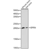 Western Blot - Anti-EPPIN Antibody (A11514) - Antibodies.com