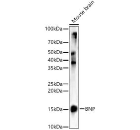 Western Blot - Anti-BNP Antibody (A11515) - Antibodies.com