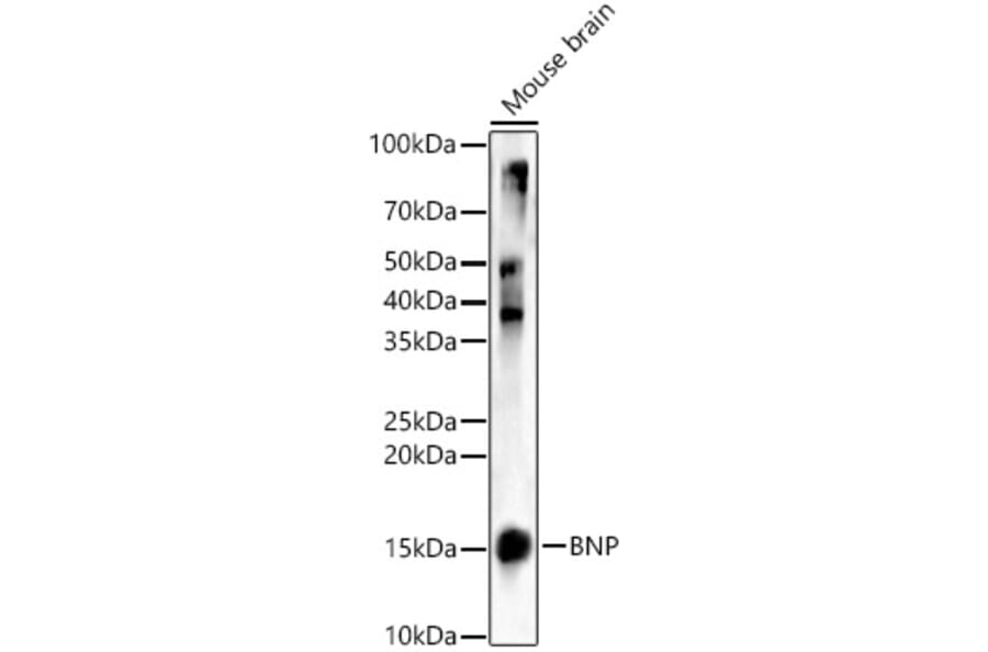 Western Blot - Anti-BNP Antibody (A11515) - Antibodies.com