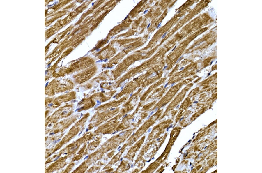 Anti-BNP Antibody (A11515) - IHC