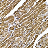 Immunohistochemistry - Anti-BNP Antibody (A11515) - Antibodies.com