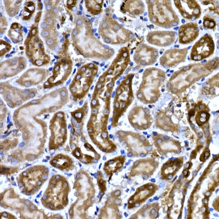 Immunohistochemistry - Anti-BNP Antibody (A11515) - Antibodies.com