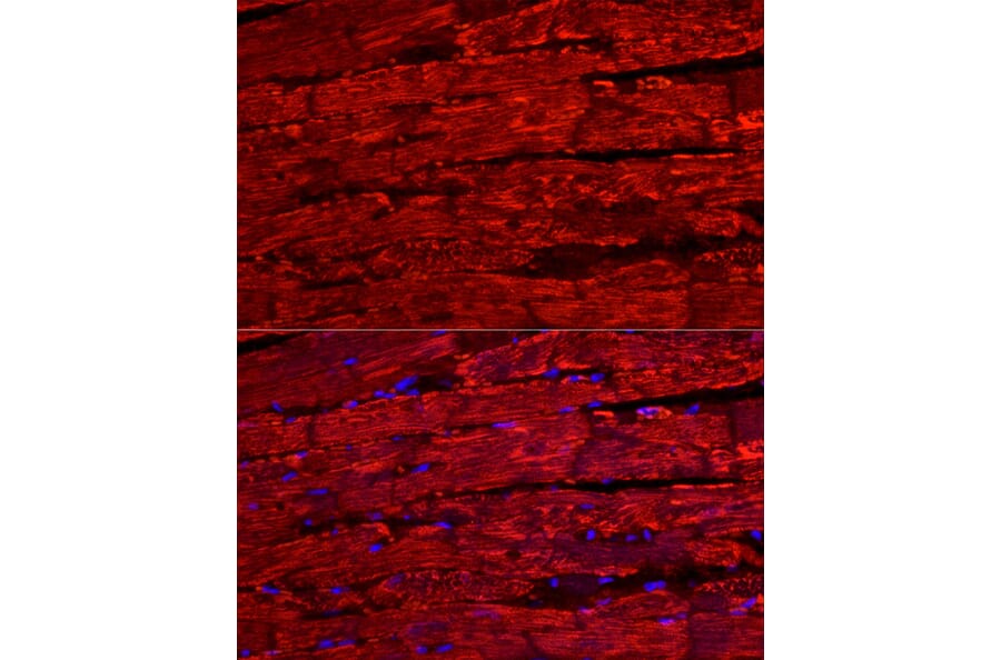 Immunofluorescence - Anti-BNP Antibody (A11515) - Antibodies.com