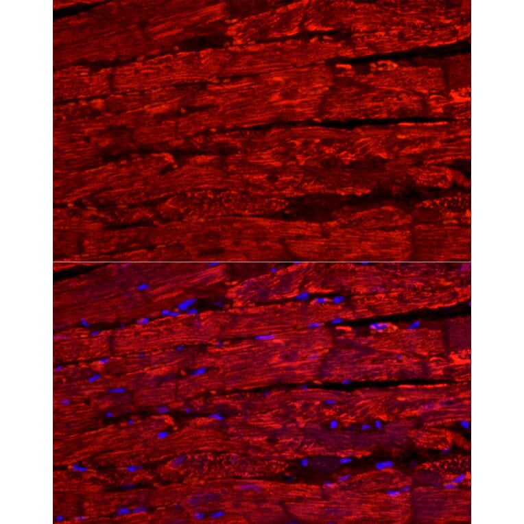 Immunofluorescence - Anti-BNP Antibody (A11515) - Antibodies.com