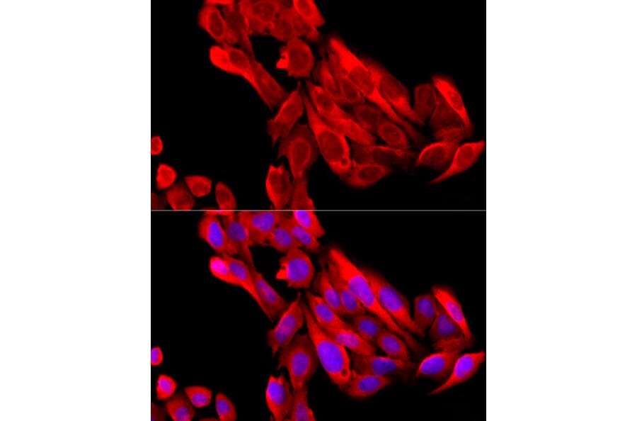 Immunofluorescence - Anti-BNP Antibody (A11515) - Antibodies.com