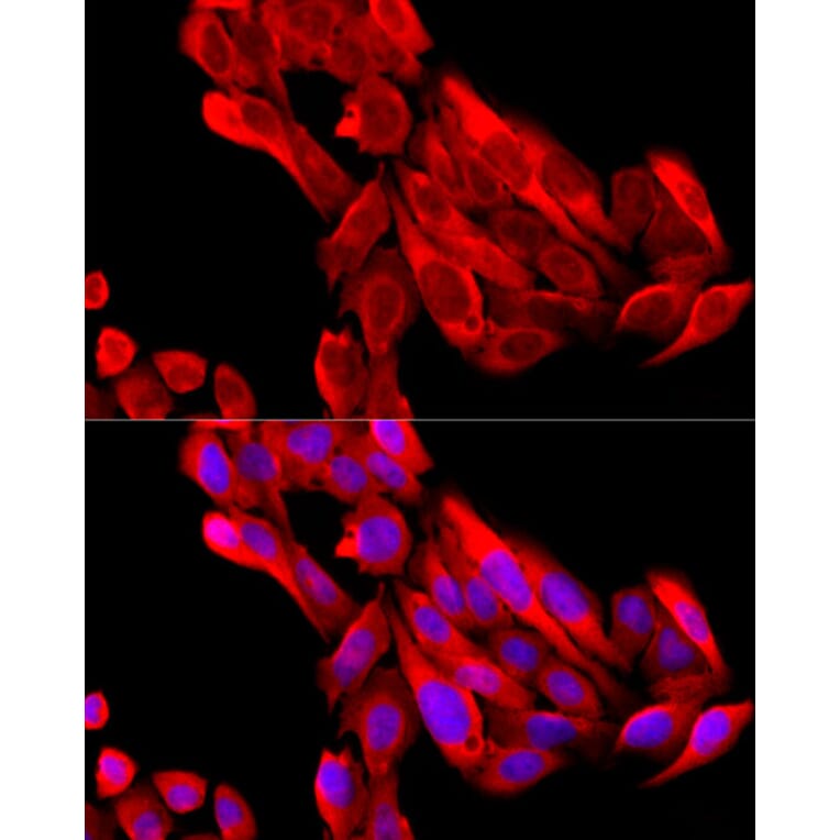 Immunofluorescence - Anti-BNP Antibody (A11515) - Antibodies.com