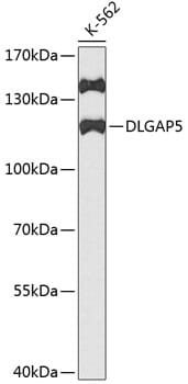 Western blot analysis of extracts of K562 cells, using Anti-DLGAP5 Antibody (A2197) at 1:1,000 dilution.
Secondary antibody: Goat Anti-Rabbit IgG (H+L) (HRP) (AS014) at 1:10,000 dilution.
Lysates / proteins: 25µg per lane.
Blocking buffer: 3% non-fat dry milk in TBST.
Detection: ECL Basic Kit (RM00020).
Exposure time: 90s.