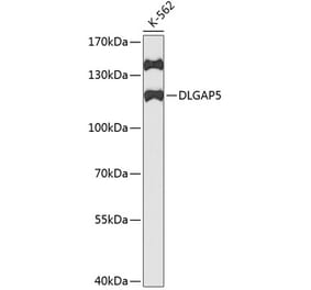 Western Blot - Anti-HURP Antibody (A11516) - Antibodies.com