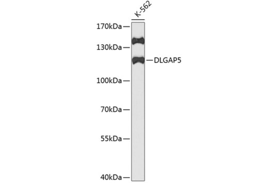 Western Blot - Anti-HURP Antibody (A11516) - Antibodies.com