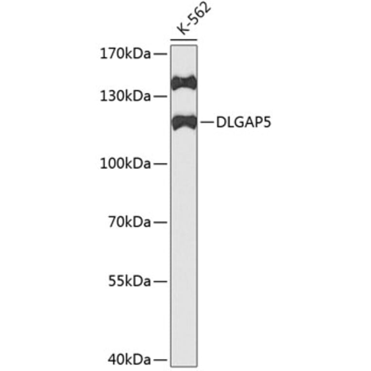 Western Blot - Anti-HURP Antibody (A11516) - Antibodies.com