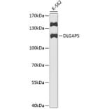 Western Blot - Anti-HURP Antibody (A11516) - Antibodies.com