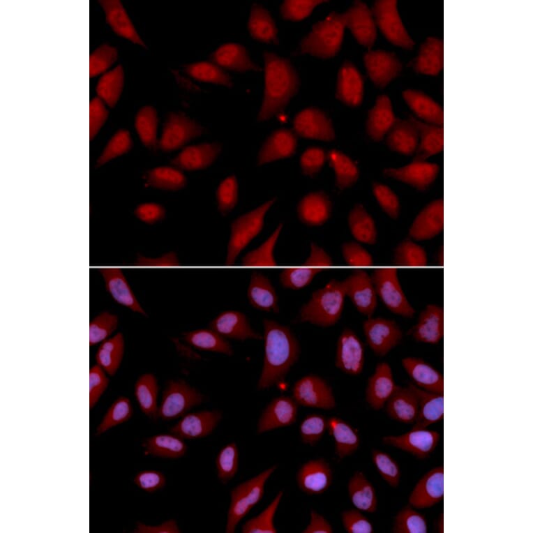 Immunofluorescence - Anti-HURP Antibody (A11516) - Antibodies.com