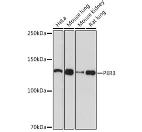 Western Blot - Anti-PER3 Antibody [ARC1893] (A11518) - Antibodies.com