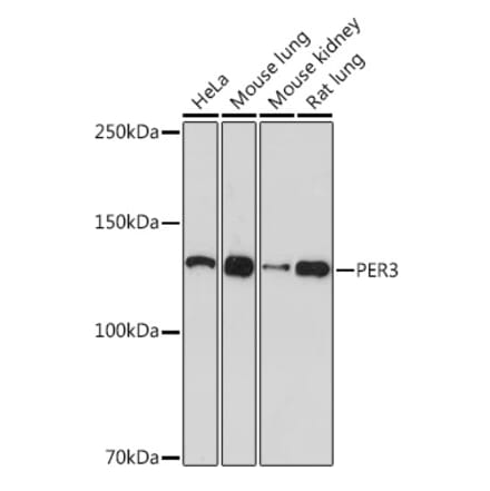 Western Blot - Anti-PER3 Antibody [ARC1893] (A11518) - Antibodies.com