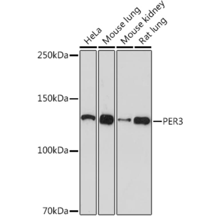 Western Blot - Anti-PER3 Antibody [ARC1893] (A11518) - Antibodies.com