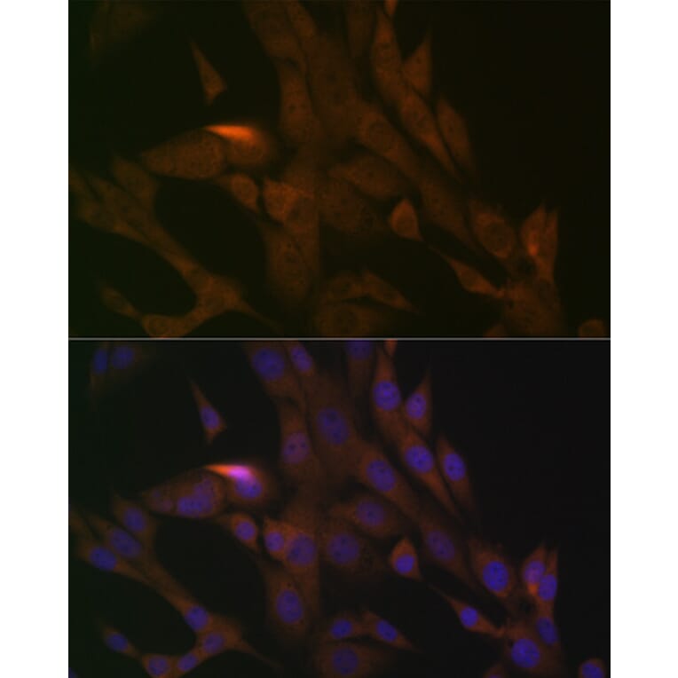 Immunofluorescence - Anti-PER3 Antibody [ARC1893] (A11518) - Antibodies.com