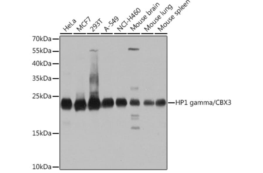 Western Blot - Anti-HP1 gamma/CBX3 Antibody (A11521) - Antibodies.com