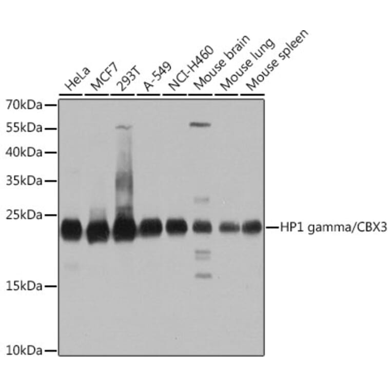 Western Blot - Anti-HP1 gamma/CBX3 Antibody (A11521) - Antibodies.com