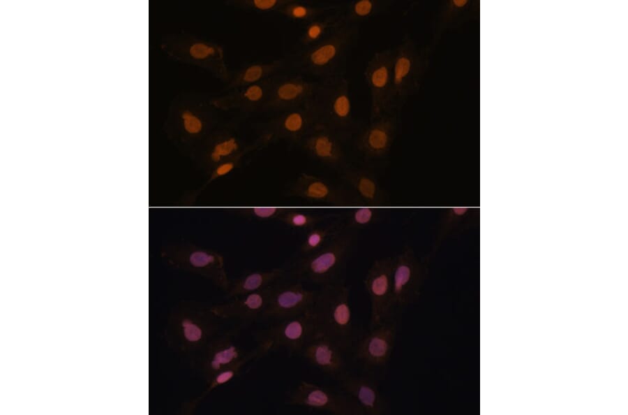 Immunofluorescence - Anti-HP1 gamma/CBX3 Antibody (A11521) - Antibodies.com