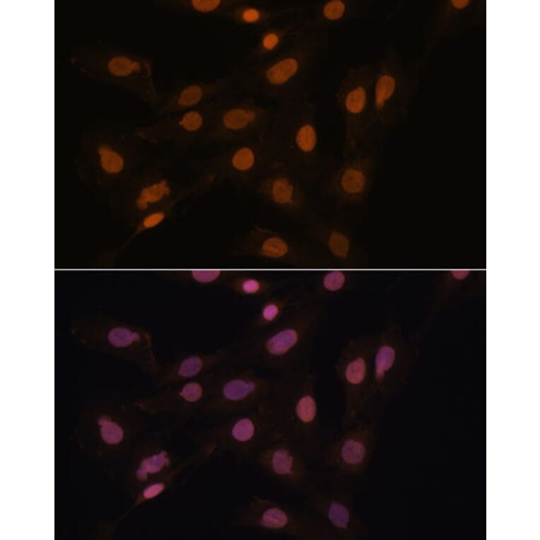 Immunofluorescence - Anti-HP1 gamma/CBX3 Antibody (A11521) - Antibodies.com