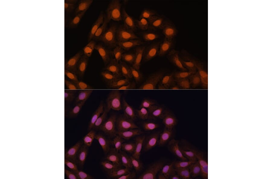 Immunofluorescence - Anti-HP1 gamma/CBX3 Antibody (A11521) - Antibodies.com