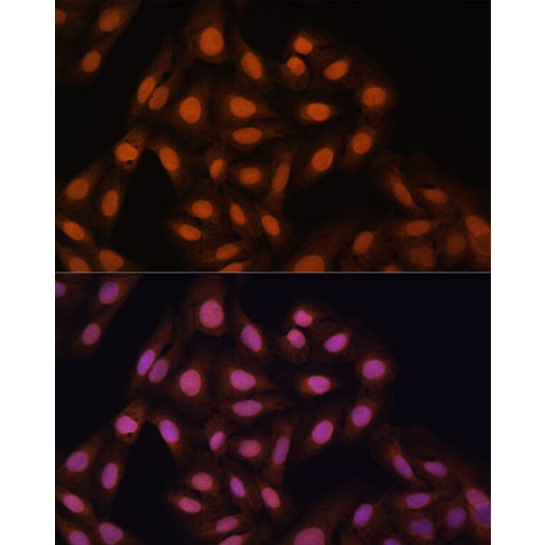 Immunofluorescence - Anti-HP1 gamma/CBX3 Antibody (A11521) - Antibodies.com