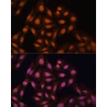 Immunofluorescence - Anti-HP1 gamma/CBX3 Antibody (A11521) - Antibodies.com