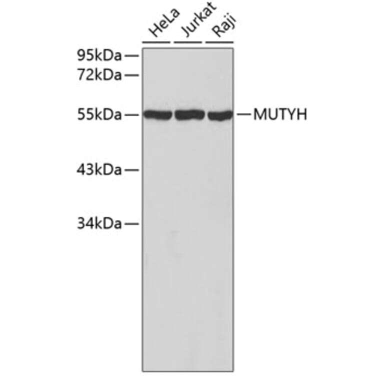 Western Blot - Anti-MUTYH Antibody (A2265) - Antibodies.com