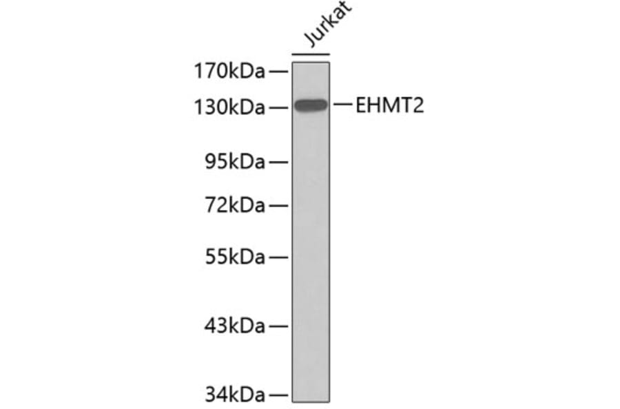 Western Blot - Anti-EHMT2/G9A Antibody (A11527) - Antibodies.com
