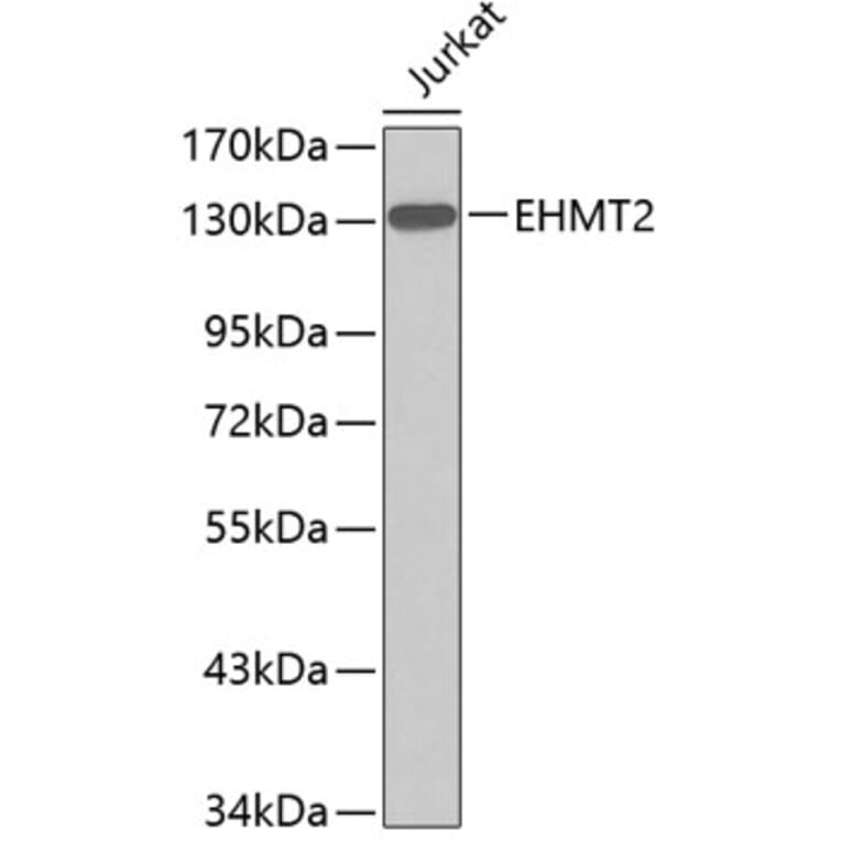 AntiEHMT2 / G9A Antibody (A11527)
