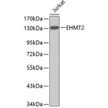 Western Blot - Anti-EHMT2/G9A Antibody (A11527) - Antibodies.com