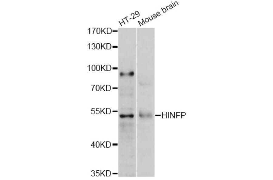 Western Blot - Anti-HINFP Antibody (A2306) - Antibodies.com
