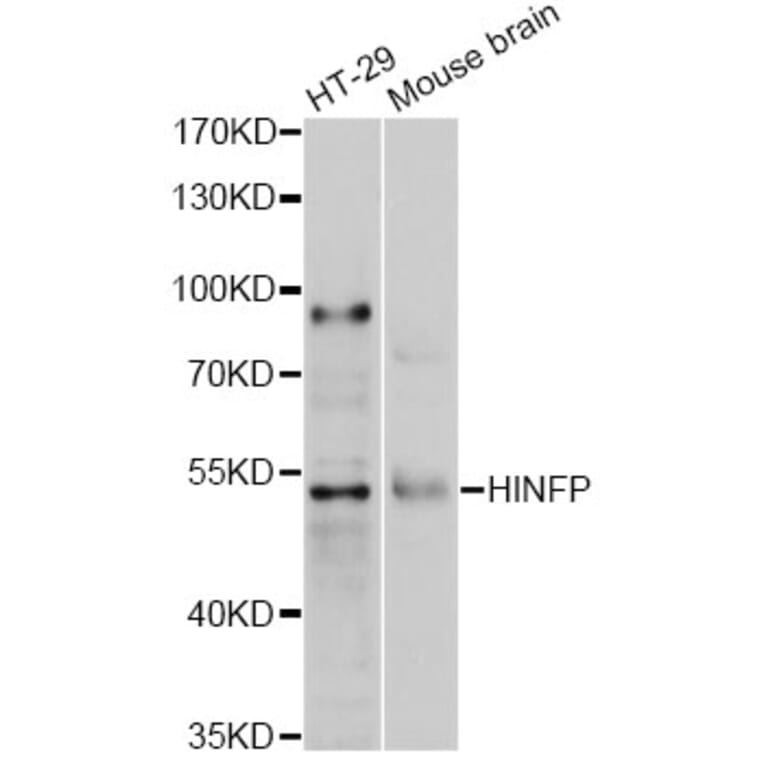 Western Blot - Anti-HINFP Antibody (A2306) - Antibodies.com