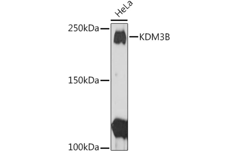 Western Blot - Anti-KDM3B/JMJD1B Antibody (A11529) - Antibodies.com