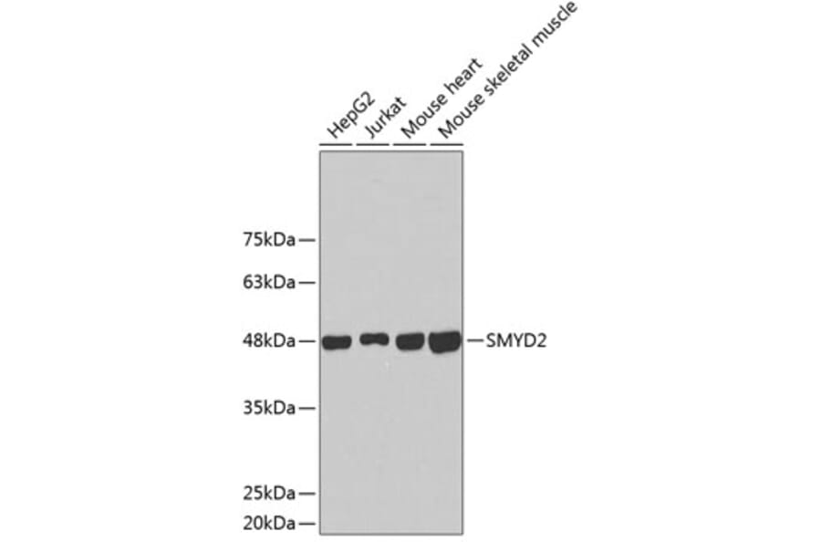 Western Blot - Anti-SMYD2 Antibody (A2327) - Antibodies.com
