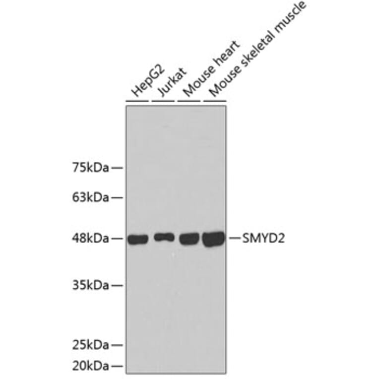 Western Blot - Anti-SMYD2 Antibody (A2327) - Antibodies.com