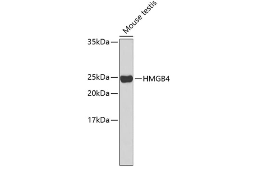Western Blot - Anti-HMGB4 Antibody (A2338) - Antibodies.com