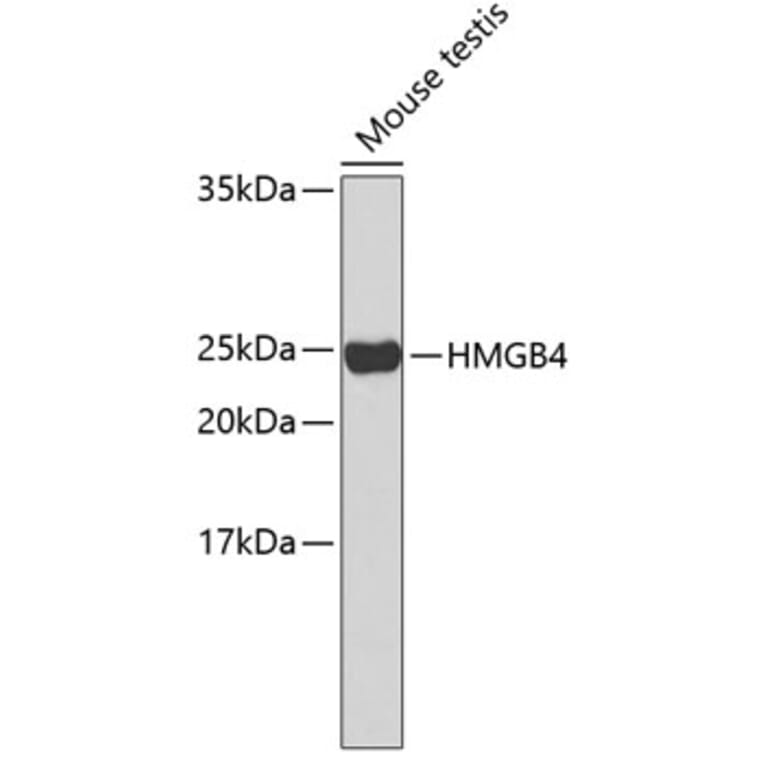 Western Blot - Anti-HMGB4 Antibody (A2338) - Antibodies.com