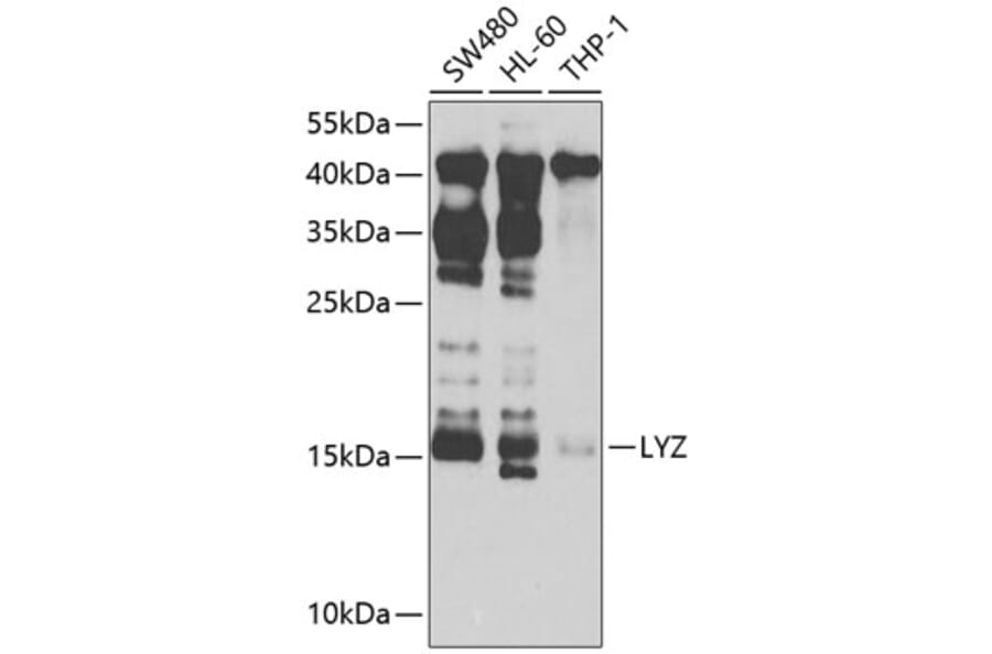 Western Blot - Anti-LYZ Antibody (A2503) - Antibodies.com
