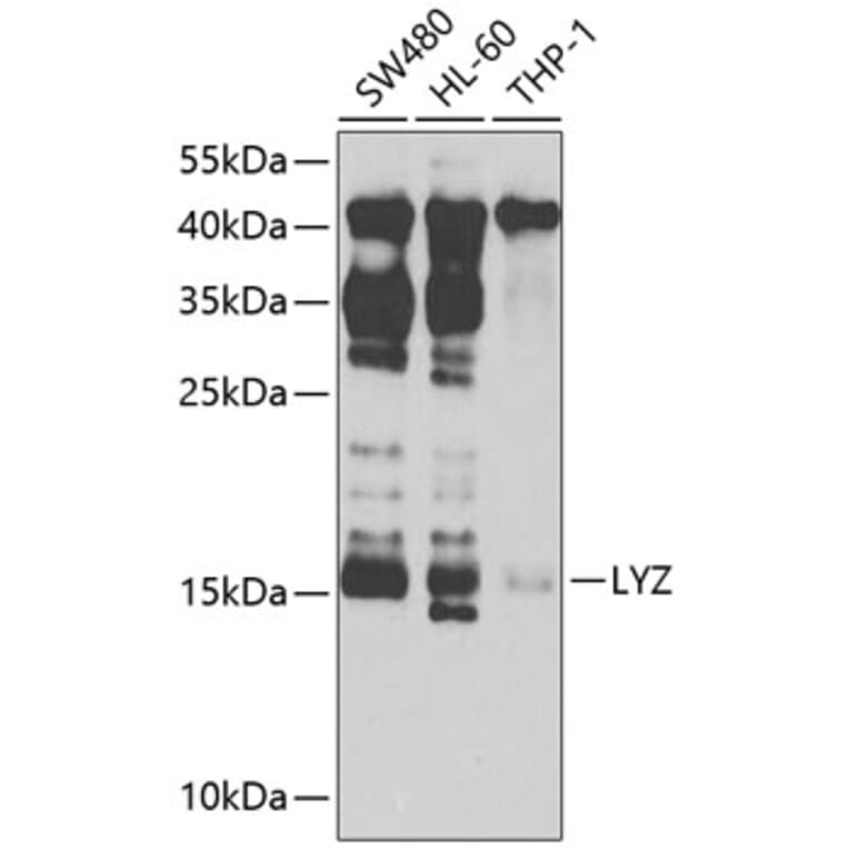 Western Blot - Anti-LYZ Antibody (A2503) - Antibodies.com
