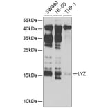 Western Blot - Anti-LYZ Antibody (A2503) - Antibodies.com