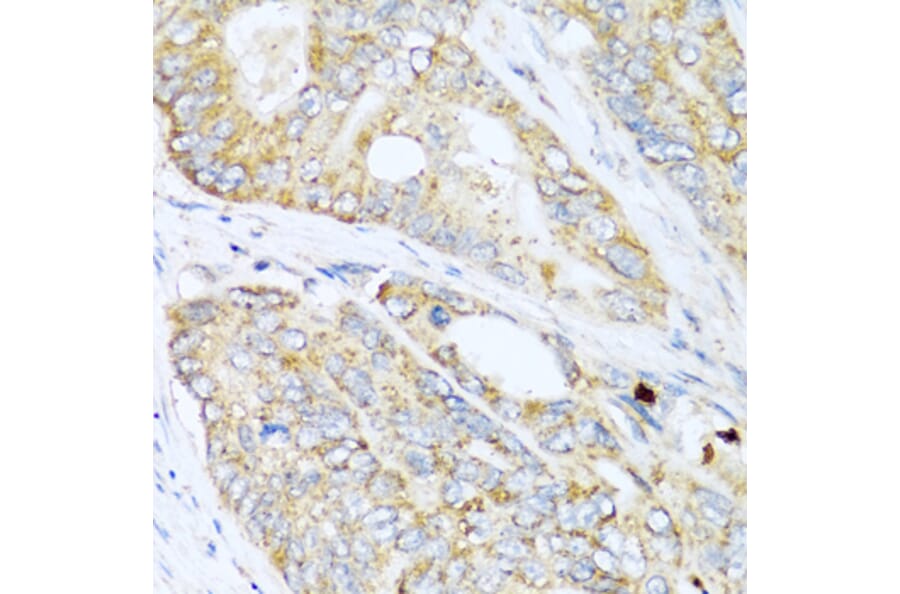 Immunohistochemistry - Anti-LYZ Antibody (A2503) - Antibodies.com