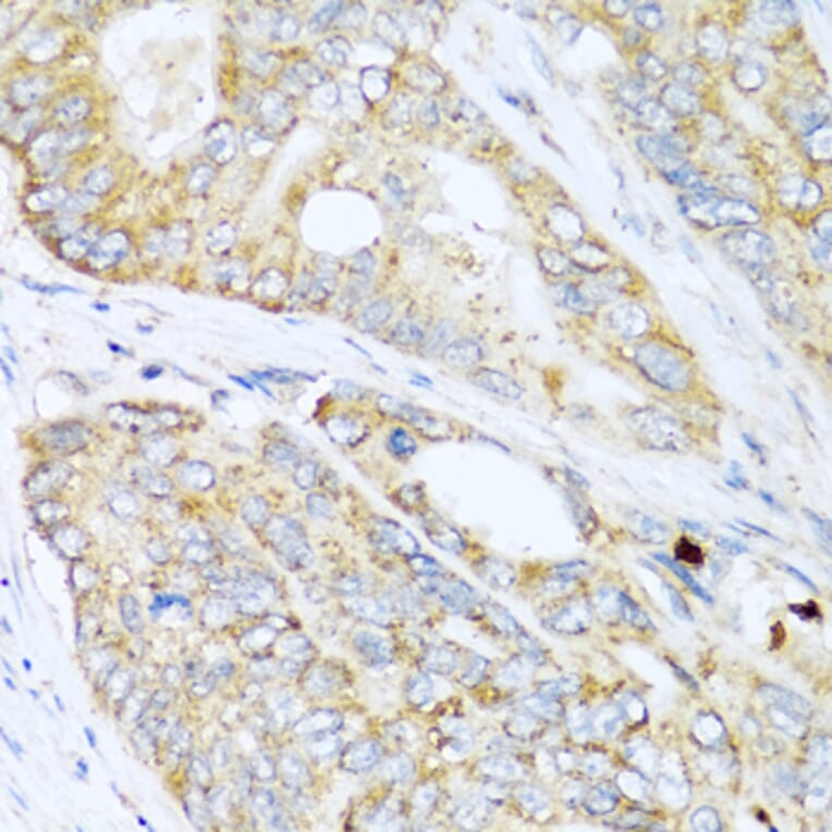 Immunohistochemistry - Anti-LYZ Antibody (A2503) - Antibodies.com