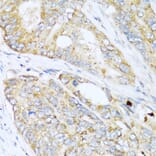 Immunohistochemistry - Anti-LYZ Antibody (A2503) - Antibodies.com