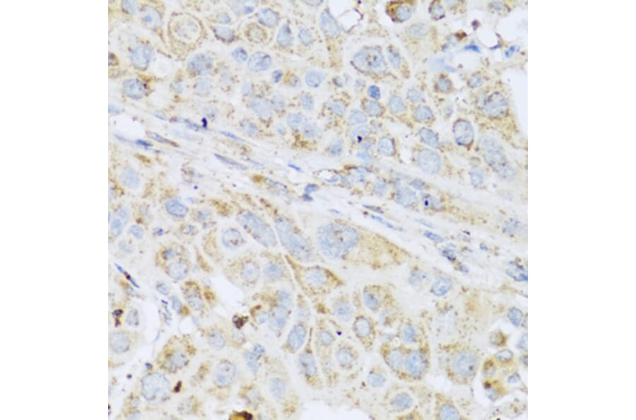 Immunohistochemistry - Anti-LYZ Antibody (A2503) - Antibodies.com
